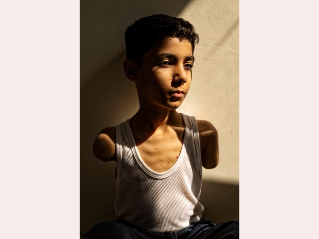 Portrait of amputee Palestinian boy from Gaza wins World Press Photo award