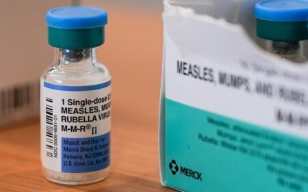 Why is measles spreading in Canada, Mexico and the US?