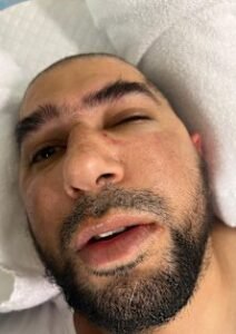 Family launches fundraiser for Perth Uber driver injured in violent passenger attack