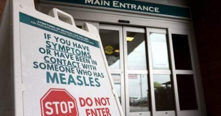 Public health warns of potential Kingston measles exposures