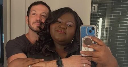Gabourey Sidibe’s Husband Brandon Frankel Diagnosed With Thyroid Cancer, Shares Update After Surgery