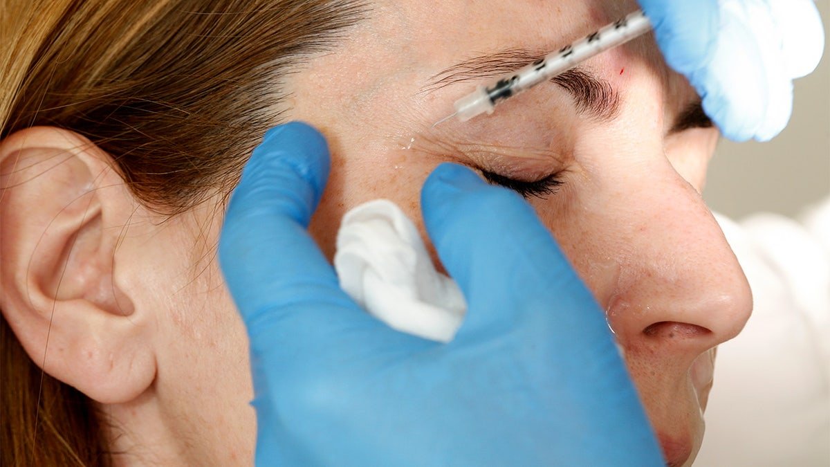 Botox injection in eye area