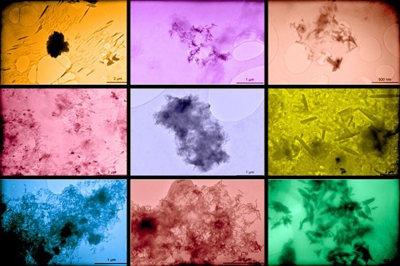 Shards of microplastic captured in kidney, liver and brain samples. Taken from the Nature Medicine Study: Bioaccumulation of Microplastics in Decedent Human Brains Assessed by Pyrolysis Gas Chromatography-Mass Spectrometry.