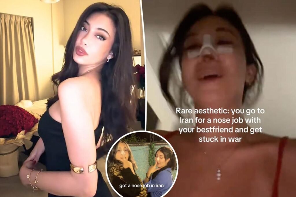 I flew to Iran for a nose job —  and woke up to the sound of bombs for 12 nights