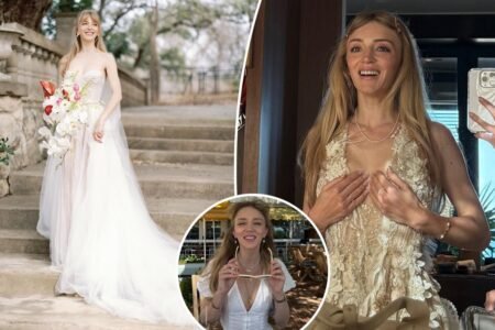 How Botox ruined my 0K wedding — and made me look like a cartoon character ‘unable to smile’