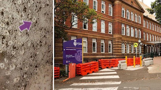 Mould uncovered at Sydney’s RPA Hospital.