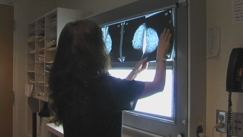 Breast cancer initiative sending patients to Alberta is reducing Sask. wait list Breast cancer initiative sending patients to Alberta is reducing Sask. wait list