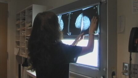 Breast cancer initiative sending patients to Alberta is reducing Sask. wait list Breast cancer initiative sending patients to Alberta is reducing Sask. wait list