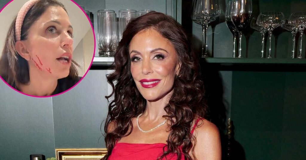 What Happened to ‘RHONY’ Alum Bethenny Frankel’s Face? Nurse Jamie Controversy Explained