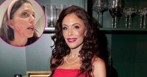What Happened to ‘RHONY’ Alum Bethenny Frankel’s Face? Nurse Jamie Controversy Explained What Happened to ‘RHONY’ Alum Bethenny Frankel’s Face? Nurse Jamie Controversy Explained