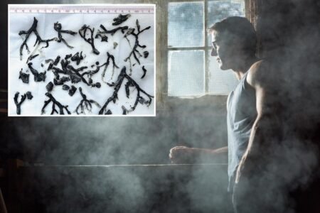 How an 87-year-old’s lungs became filled with black, rubbery plugs — and he survived