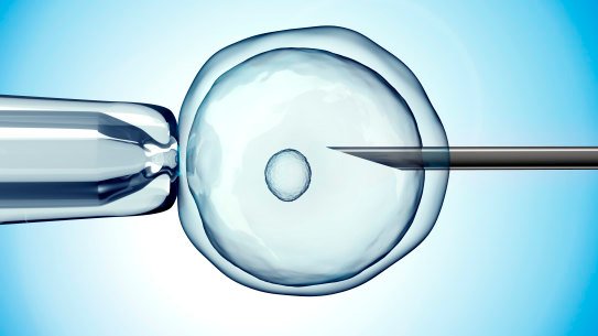 Invented in the 1990s, ICSI was designed for couples with severe male infertility,