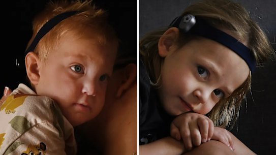 Ashton and Rowdy, from Dubbo, both require bone conduction hearing aids because of ear issues.