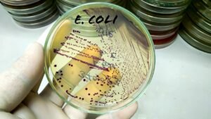 Chinese researcher on US visa pleads guilty to smuggling E. coli into the country