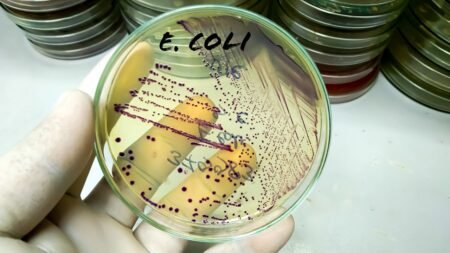 Chinese researcher on US visa pleads guilty to smuggling E. coli into the country Chinese researcher on US visa pleads guilty to smuggling E. coli into the country