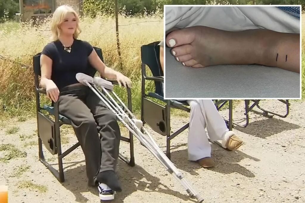 SoCal girl, 14, reveals horrific injuries after rattlesnake nearly killed her: ‘My hearing went out’ SoCal girl, 14, reveals horrific injuries after rattlesnake nearly killed her: ‘My hearing went out’