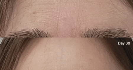 Wrinkles Between Your Eyebrows? This 3-Minute Treatment Can Make You Look 10 Years Younger Wrinkles Between Your Eyebrows? This 3-Minute Treatment Can Make You Look 10 Years Younger