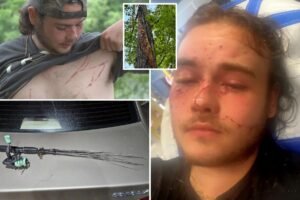 Fisherman survives lightning strike that left him covered in burns: ‘Unluckiest lucky man alive’ Fisherman survives lightning strike that left him covered in burns: ‘Unluckiest lucky man alive’