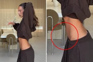Influencer trashed for apparently manipulating photo to flatten belly — with bizarre result: ‘OMG this is insane’ Influencer trashed for apparently manipulating photo to flatten belly — with bizarre result: ‘OMG this is insane’