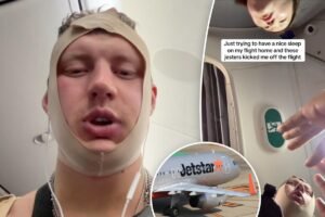 ‘Looksmaxxer’ Androgenic kicked off plane over alarming behavior following extreme facial surgery: ‘Your face is very ill’
