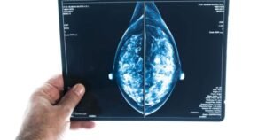 These are the Canadian regions with the highest rates of breast cancer