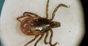 Ticks are coming for you: Experts warn tick-related illnesses rising across Canada