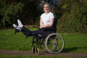 21-year-old to have legs amputated after legs locked straight, bent backwards