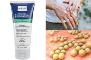 Skin cream sold on Amazon recalled over deadly bacteria risk Skin cream sold on Amazon recalled over deadly bacteria risk
