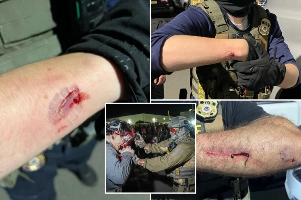 Anti-ICE agitator charged with allegedly biting officers during Delaney Hall protest Anti-ICE agitator charged with allegedly biting officers during Delaney Hall protest