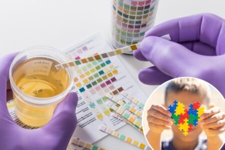 New urine test could diagnose autism in children: study New urine test could diagnose autism in children: study
