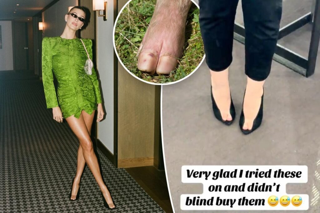 .1K Valentino ‘pig’s hoof’ pumps beloved by Hailey Bieber sorely divide fashion fiends
