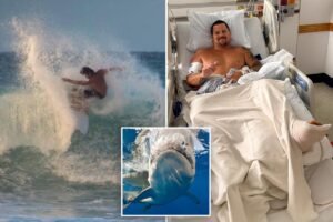 Surfer describes how 8-foot shark ripped open his legs: ‘My calf is pretty much wide open’