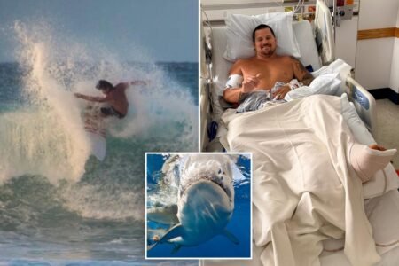 Surfer describes how 8-foot shark ripped open his legs: ‘My calf is pretty much wide open’ Surfer describes how 8-foot shark ripped open his legs: ‘My calf is pretty much wide open’