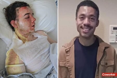 California McDonald’s boss breaks silence after coworker scalded him with boiling hot oil: ‘One of the hardest things of my life’