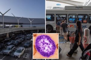 Measles case reported at LAX as global World Cup travel sparks fears of spread Measles case reported at LAX as global World Cup travel sparks fears of spread