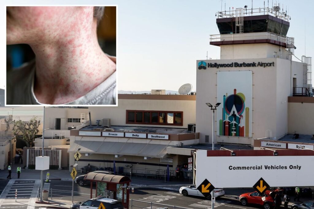 World’s most contagious disease found at busy California airport
