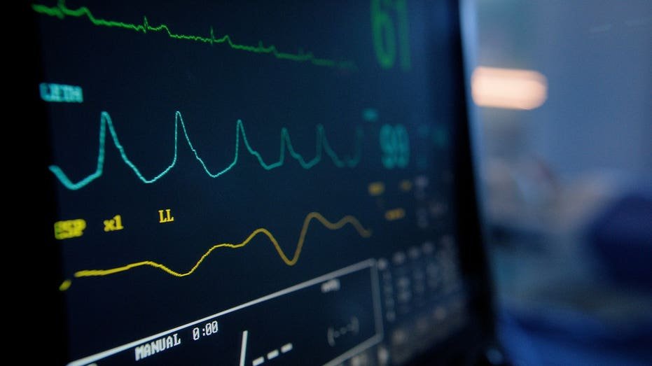 Vital signs monitor displaying heart rate and EKG readings in hospital ICU