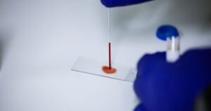 2 New Studies Confirm Your Bloodstream Contains Surprising Anti-Aging Compounds. Here’s What They Are 2 New Studies Confirm Your Bloodstream Contains Surprising Anti-Aging Compounds. Here’s What They Are