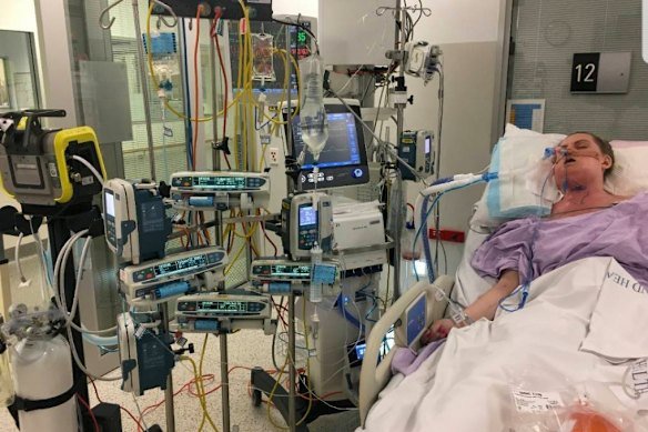 Caitlin Alsop spent nine days in a coma in intensive care.