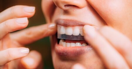 Run! The Bestselling Whitening Strips for Sensitive Teeth Just Hit Their Lowest Price of the Year Run! The Bestselling Whitening Strips for Sensitive Teeth Just Hit Their Lowest Price of the Year