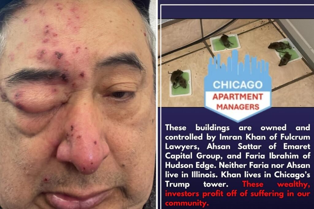 Chicago renter woke up to rats gnawing on his face after complaining about infestation to landlord for months