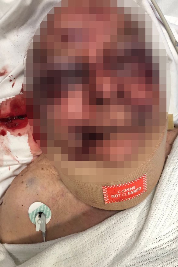 An 87-year-old man was hospitalised after being assaulted by another resident at a specialist dementia care home.