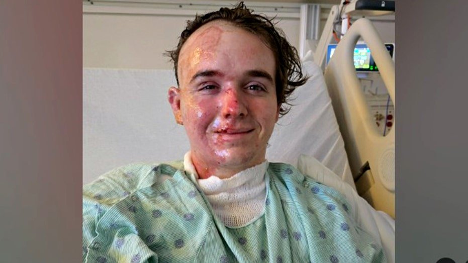 Jacob Smith smiling in hospital gown