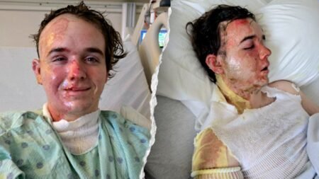 McDonald’s worker allegedly doused with hot cooking oil by co-worker, suffers burns over 22% of his body