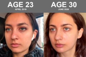 30 going on 21: Bryan Johnson’s girlfriend reveals extreme biohacking that made her skin age backwards