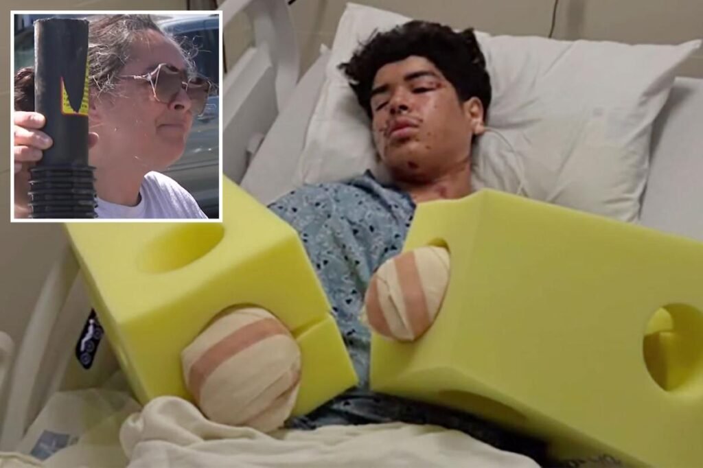 California mom goes ballistic after teen son’s hands are blown to pieces after near-deadly mistake California mom goes ballistic after teen son’s hands are blown to pieces after near-deadly mistake