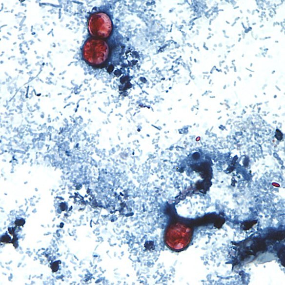 Cyclospora oocysts (the thick-walled infectious stage of a parasite) as seen through a microscope.