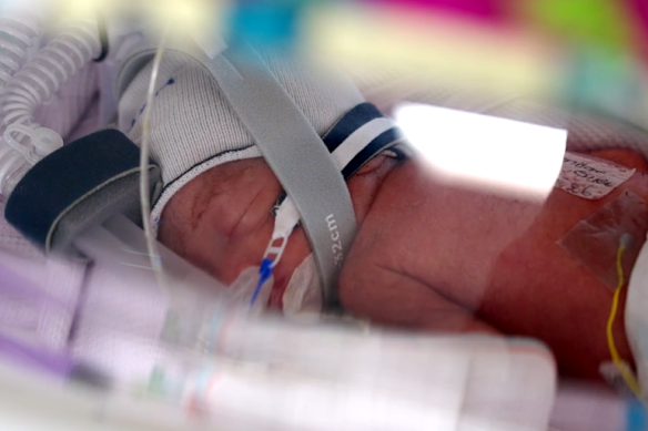 The healthy identical quadruplets were born at 28 weeks and four days.