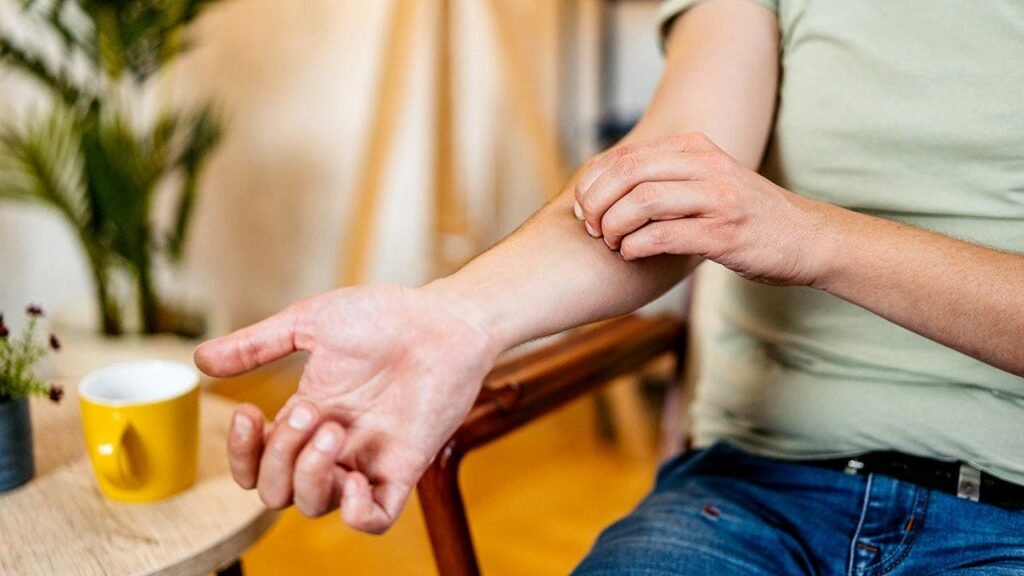 Why scratching a mosquito bite makes it so much worse, according to science Why scratching a mosquito bite makes it so much worse, according to science