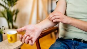 Why scratching a mosquito bite makes it so much worse, according to science Why scratching a mosquito bite makes it so much worse, according to science